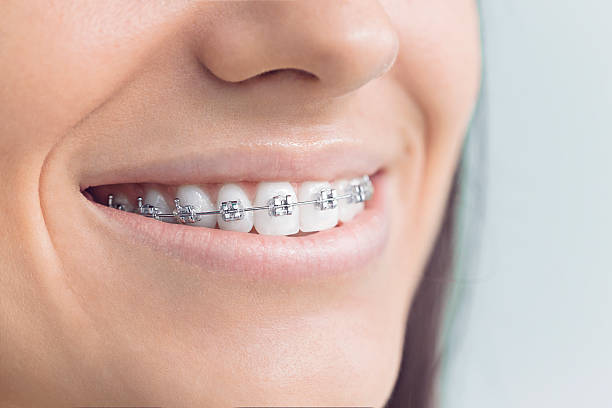 Best Dental Fillings (Composite and Amalgam)  in Lyndhurst, VA